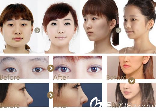 杭州藝星整形樸正馨<span style= 杭州藝星整形樸正馨<span style=