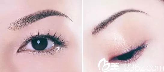 紋眉手術(shù)效果 紋眉手術(shù)效果