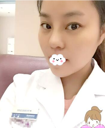 快看啊閨蜜小雪找江門華美整形美容醫(yī)院歐國升院長做的隆鼻案例美翻了