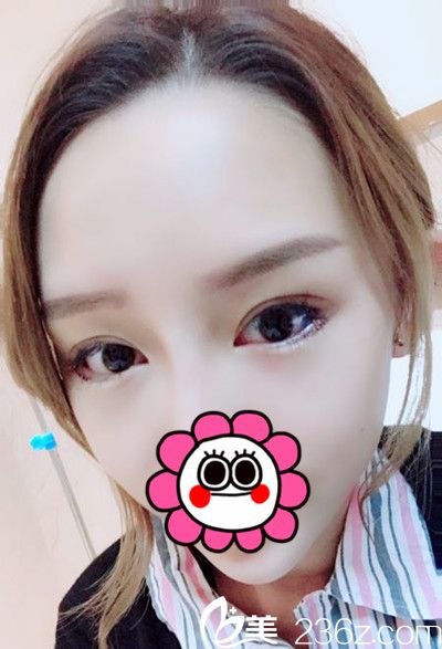 <!--<i data=20240703-sp></i>-->下眼瞼下至手術(shù)當天 <!--<i data=20240703-sp></i>-->下眼瞼下至手術(shù)當天