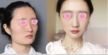 北京圣嘉榮黃大勇改臉型<span style= 北京圣嘉榮黃大勇改臉型<span style=