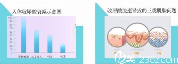 打玻尿酸面部僵硬應(yīng)該怎么辦？