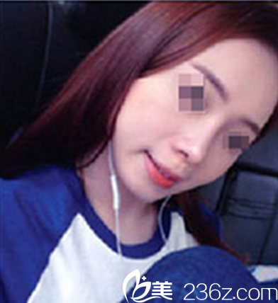 考慮再三，我選擇了在四川廣元醫(yī)爾美華美找董甫生做鼻綜合，看我隆鼻后得美照