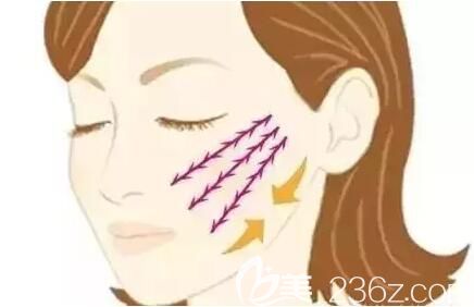 面部線雕之后會導(dǎo)致面部變得僵硬嗎？