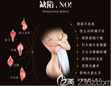 私密缺陷9大點