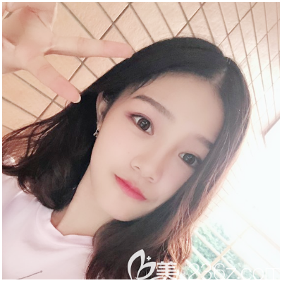 東莞哪家醫(yī)院做雙眼皮比較好？看我剛找東莞韓美王仁斌主任做的眼綜合效果怎么樣