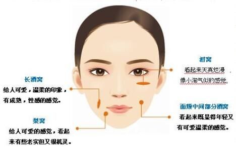 什么是酒窩成型術(shù)