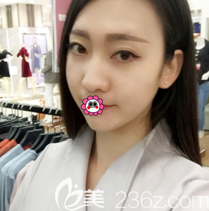 北京脂肪填充全臉哪家好?北京潤(rùn)美玉之光脂肪?？漆t(yī)院自體脂肪面部填充案例告訴你