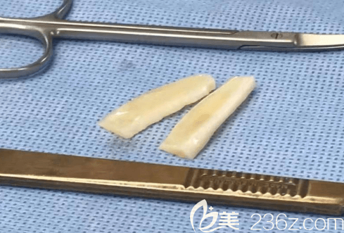 在韓國Profile普羅菲耳做貼發(fā)耳矯正使用的材料