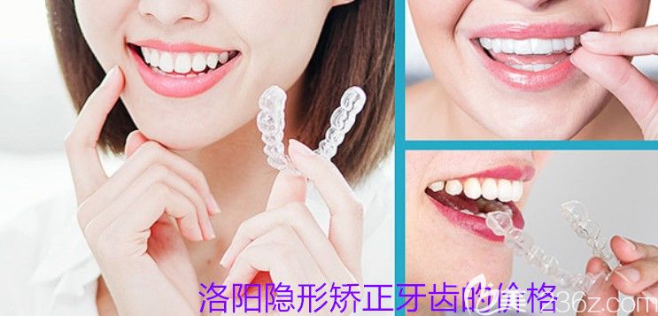 洛陽隱形矯正牙齒多少錢？牙大夫口腔正雅隱形牙套價格2萬起