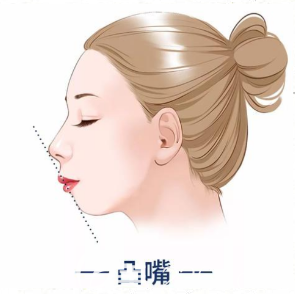 韓國菲斯萊茵凸嘴手術