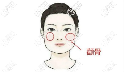 顴骨位置圖解