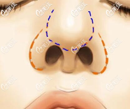 鼻頭的組成部分 鼻頭的組成部分