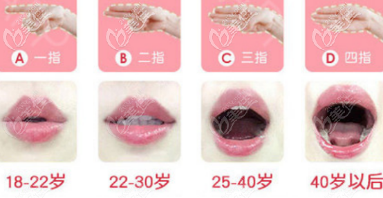陰道衰老程度圖