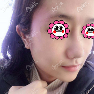 體驗(yàn)北京藝星埋線提升技術(shù)還不錯(cuò)