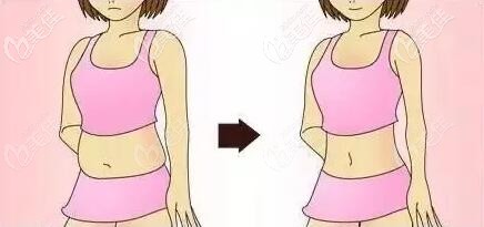 三亞做吸脂好的醫(yī)院有哪家？