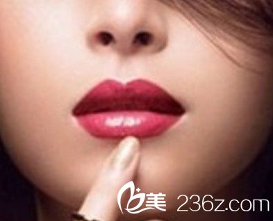 進行唇部整形之前有哪些事項是需要知道的？